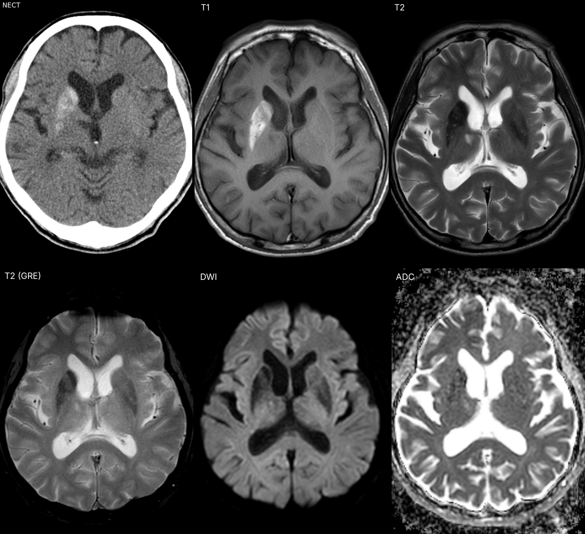 case_image