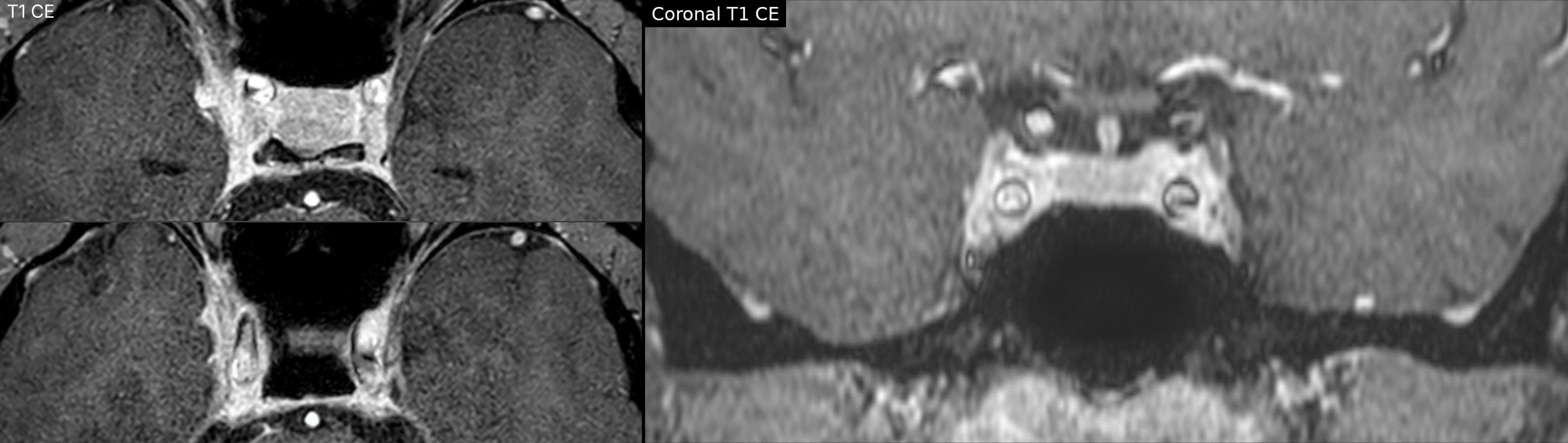 case_image