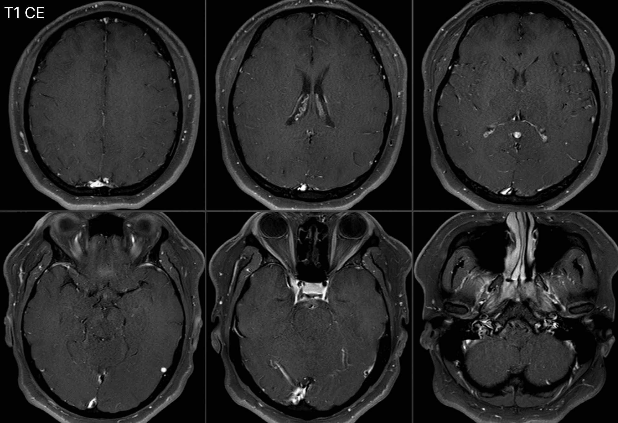 case_image